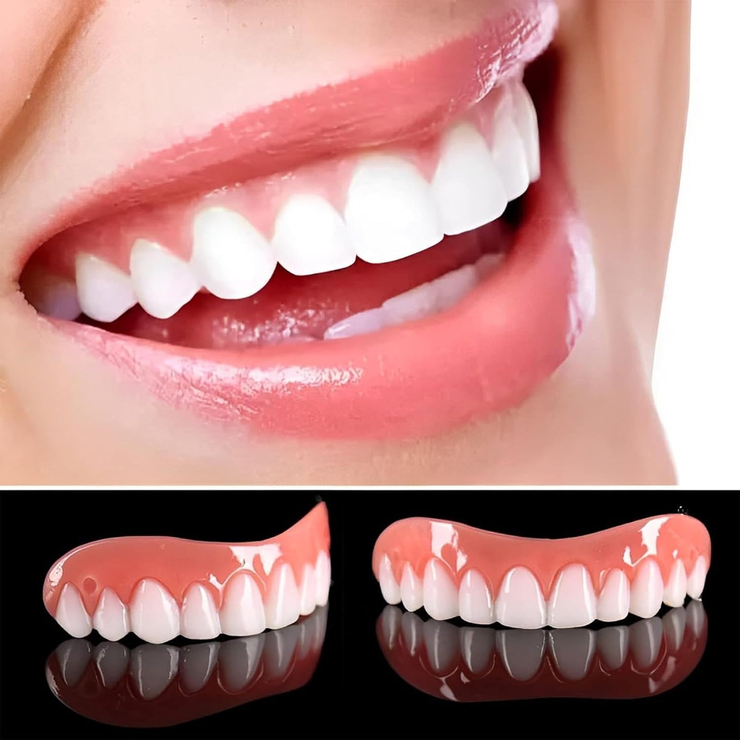 إبتسامة هوليود سمايل