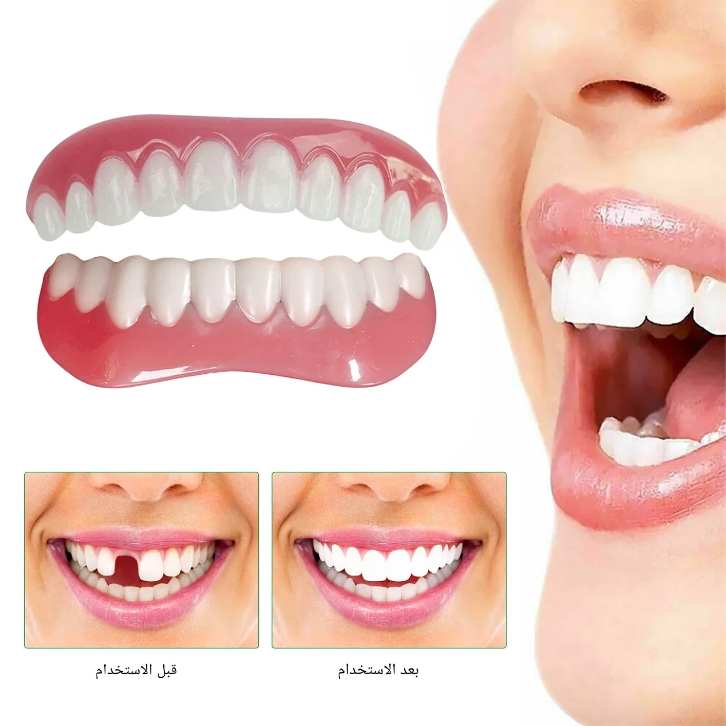 إبتسامة هوليود سمايل