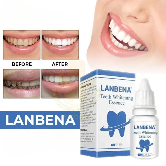 لتبييض الأسنان LANBENA