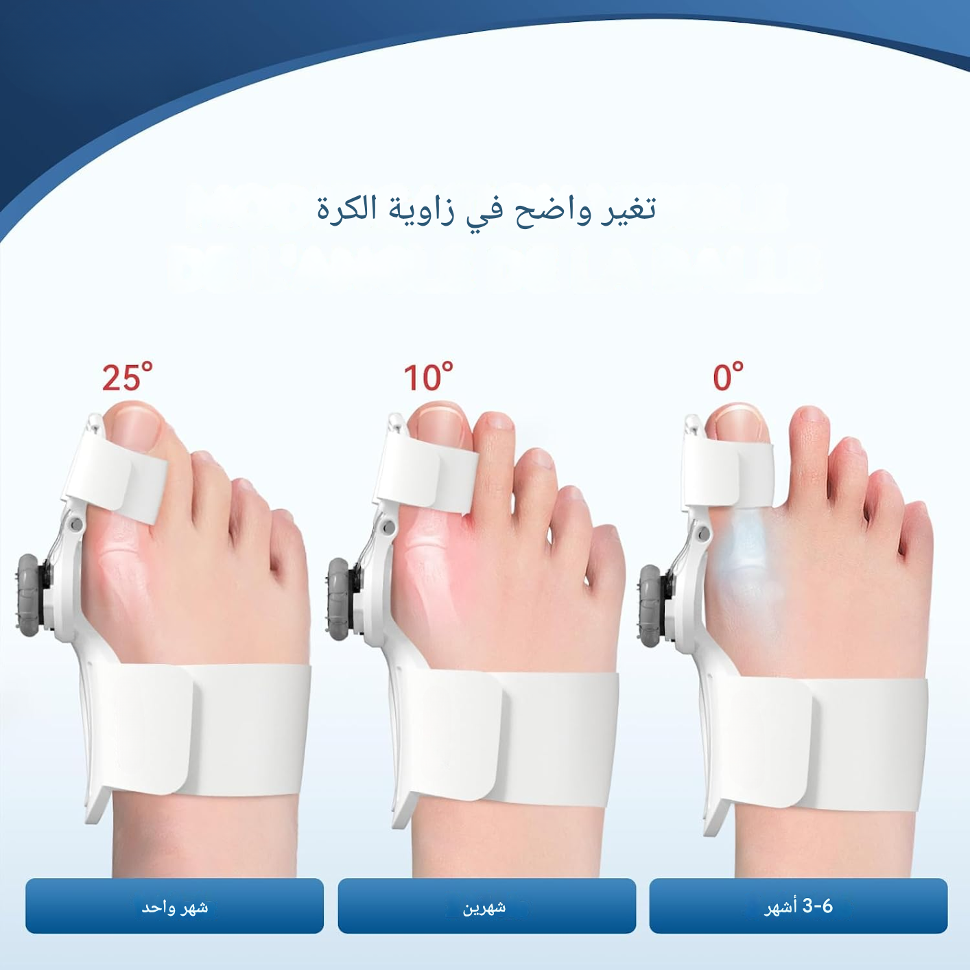 مصحح إبهام القدم